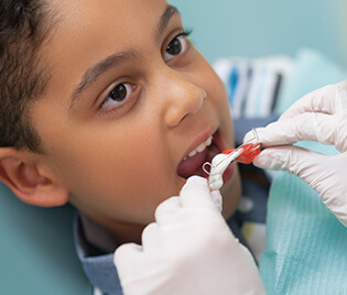 young boy having aligners placed on his teeth